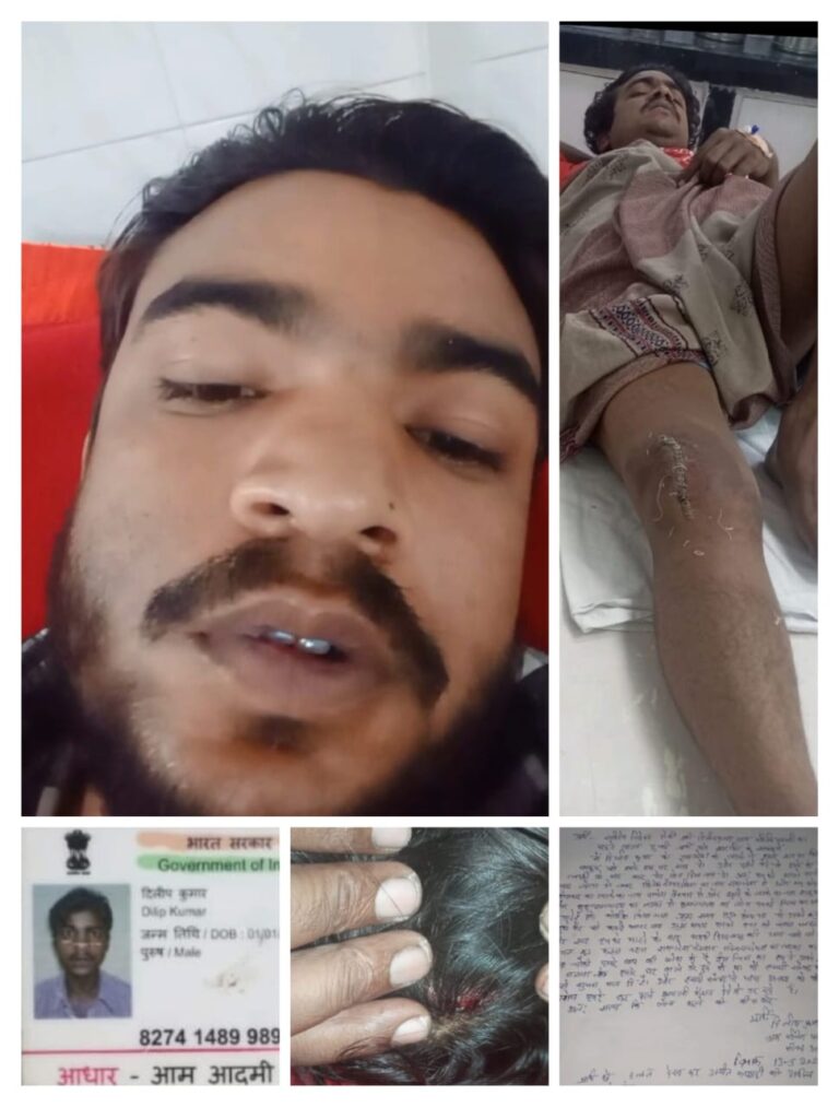 पश्चिमी परासी में दबंगों का कहर: दिलीप कुमार को लाठी-डंडों से पीटकर किया लहूलुहान, पैर तोड़ा, परिवार में दहशत का माहौल