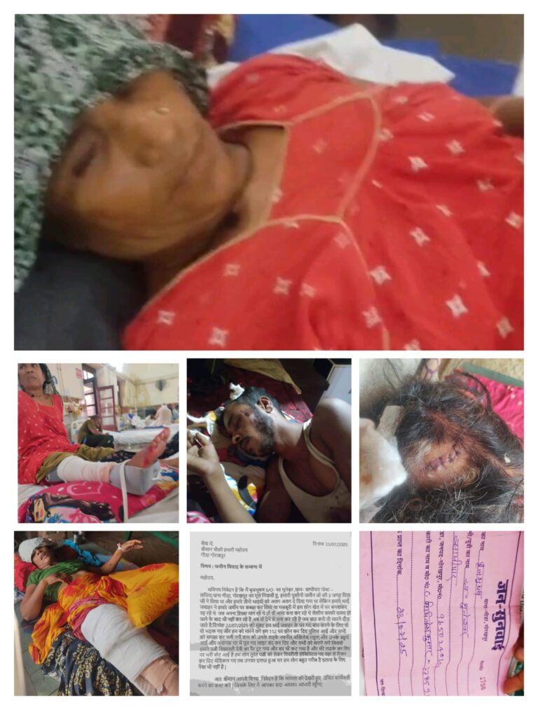 गोरखपुर: पुश्तैनी ज़मीन के विवाद में एक ही परिवार के बीच हिंसक झड़प, गर्भवती महिला सहित कई लोग गंभीर रूप से घायल