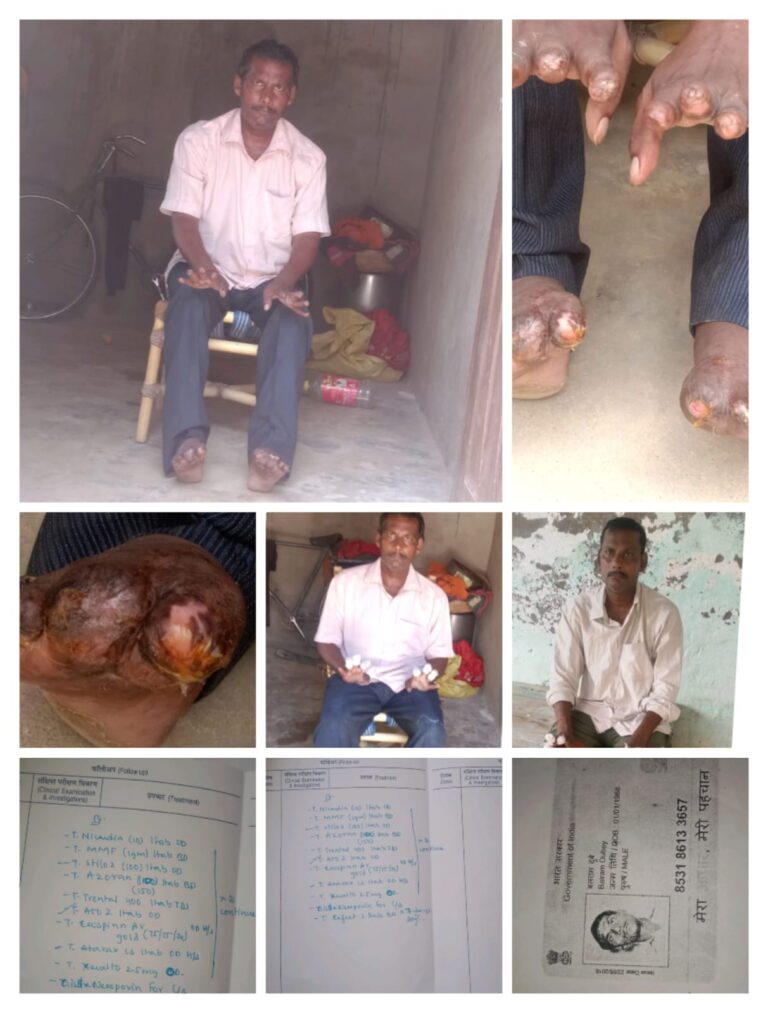 बीमारी ने छीनी जिंदगी की रफ्तार, अब मदद की दरकार: बलराम दुबे ने लगाई आर्थिक सहायता की गुहार