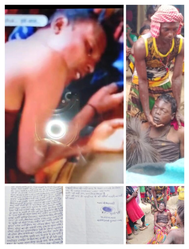 घर में आगजनी और मारपीट, घायल कई, भाई की साजिशन हत्या का आरोप