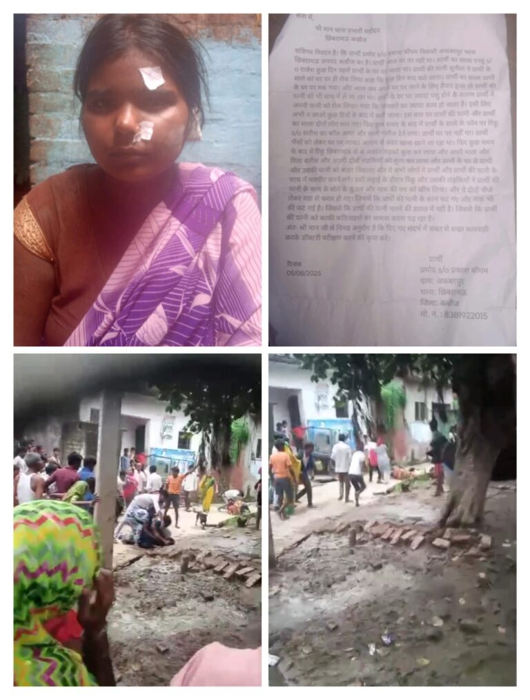 कन्नौज: महिला के साथ मारपीट कर कान और नाक के गहने छीन ले गए हमलावर, पीड़िता की हालत गंभीर