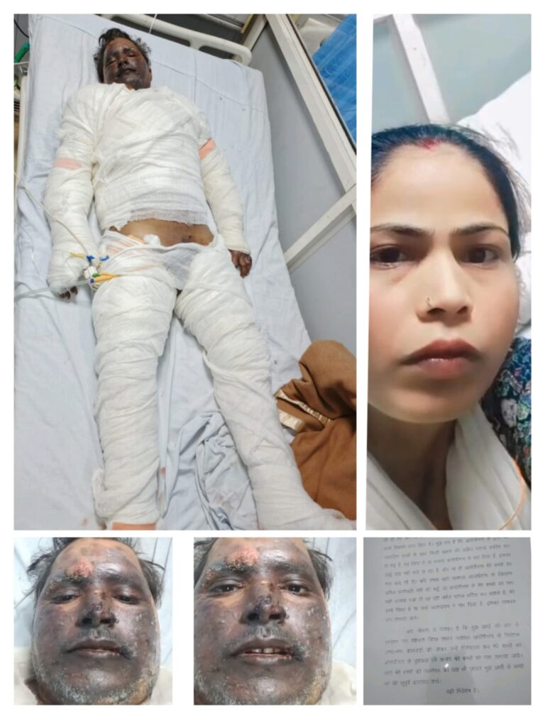 भट्टी फटने से झुलसे हरपालपुर निवासी अमरेश की इलाज के दौरान मौत, परिवार में मातम