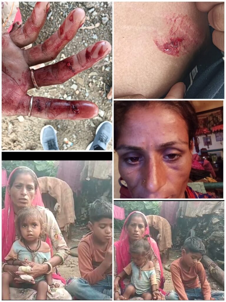 राजसमन्द में नाबालिग विवाह के बाद पत्नी के साथ दहेज की मांग और मारपीट का मामला