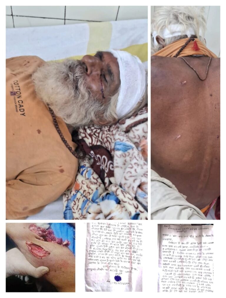 समस्तीपुर: दबंगई और राजनीति के साए में पीड़ित परिवार न्याय को तरसा