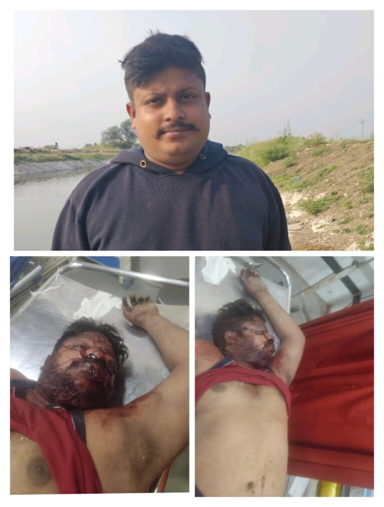 रेडियो स्टेशन के पास बेरहमी से हत्या, पैसे न देने पर युवक को पत्थर से कुचला, सुनवाई न होने से परिवार बेहाल