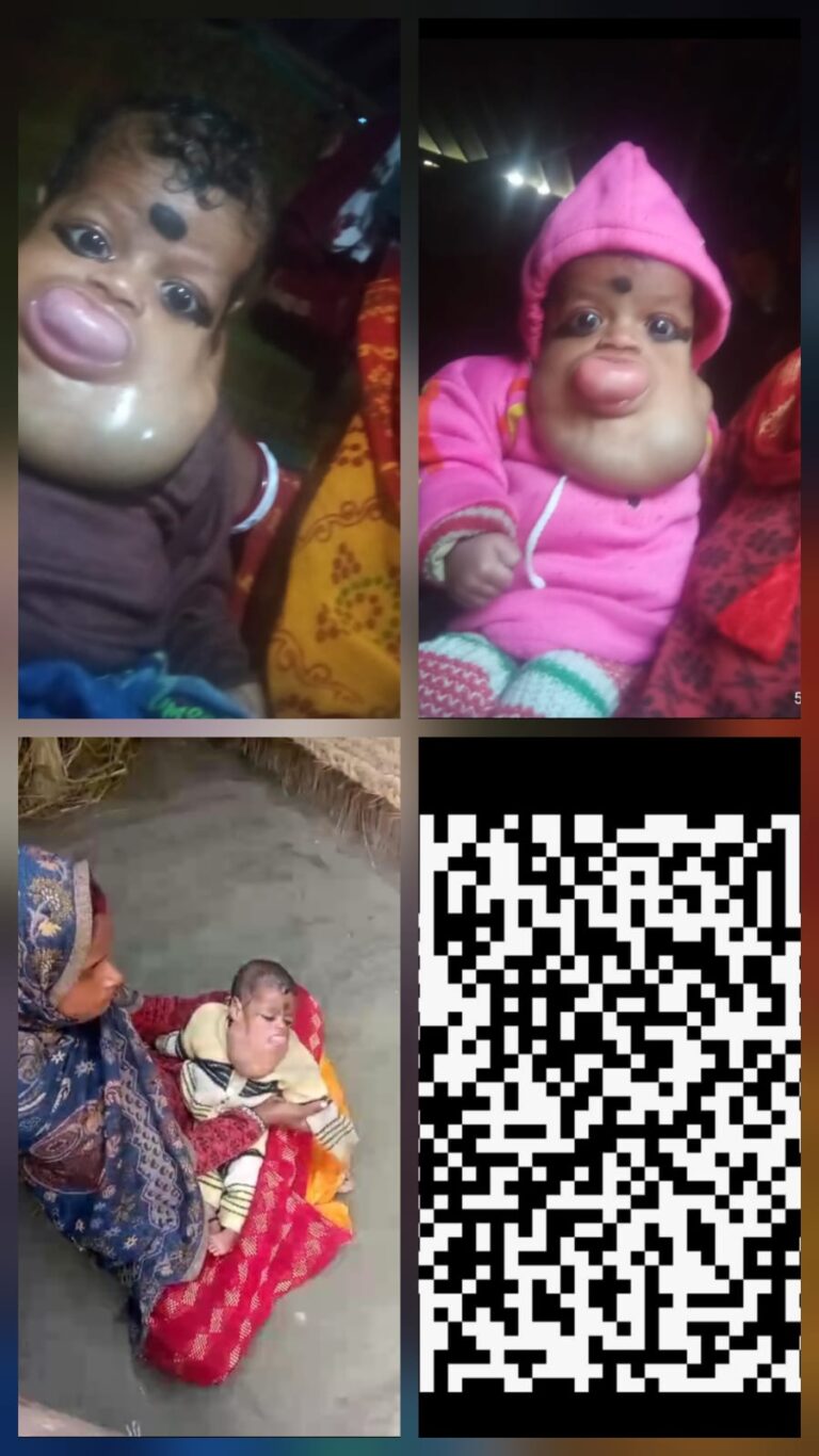 6 महीने का मासूम जिंदगी और मौत से जूझ रहा, इलाज के लिए सरकार से मदद की गुहार
