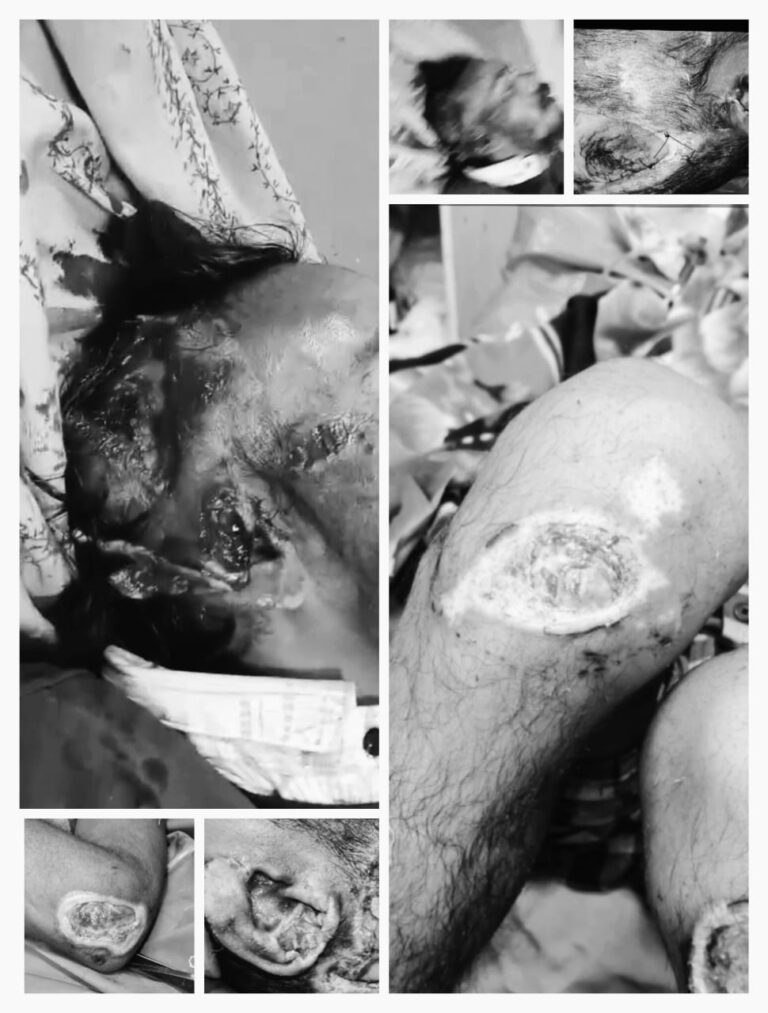 रोहिणी सेक्टर-27 हादसा: वाहन संख्या DL1L AG 8652 से कुचला गया मोनू, नागेंद्र के वाहन चलाने का आरोप