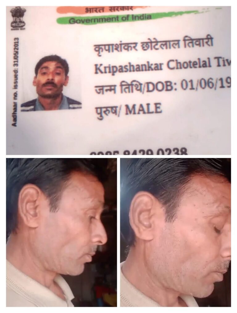 भदोही में विकलांग व्यक्ति से पुलिस की कथित बदसलूकी, बिना हेलमेट रोकने पर मारपीट और धमकी का आरोप