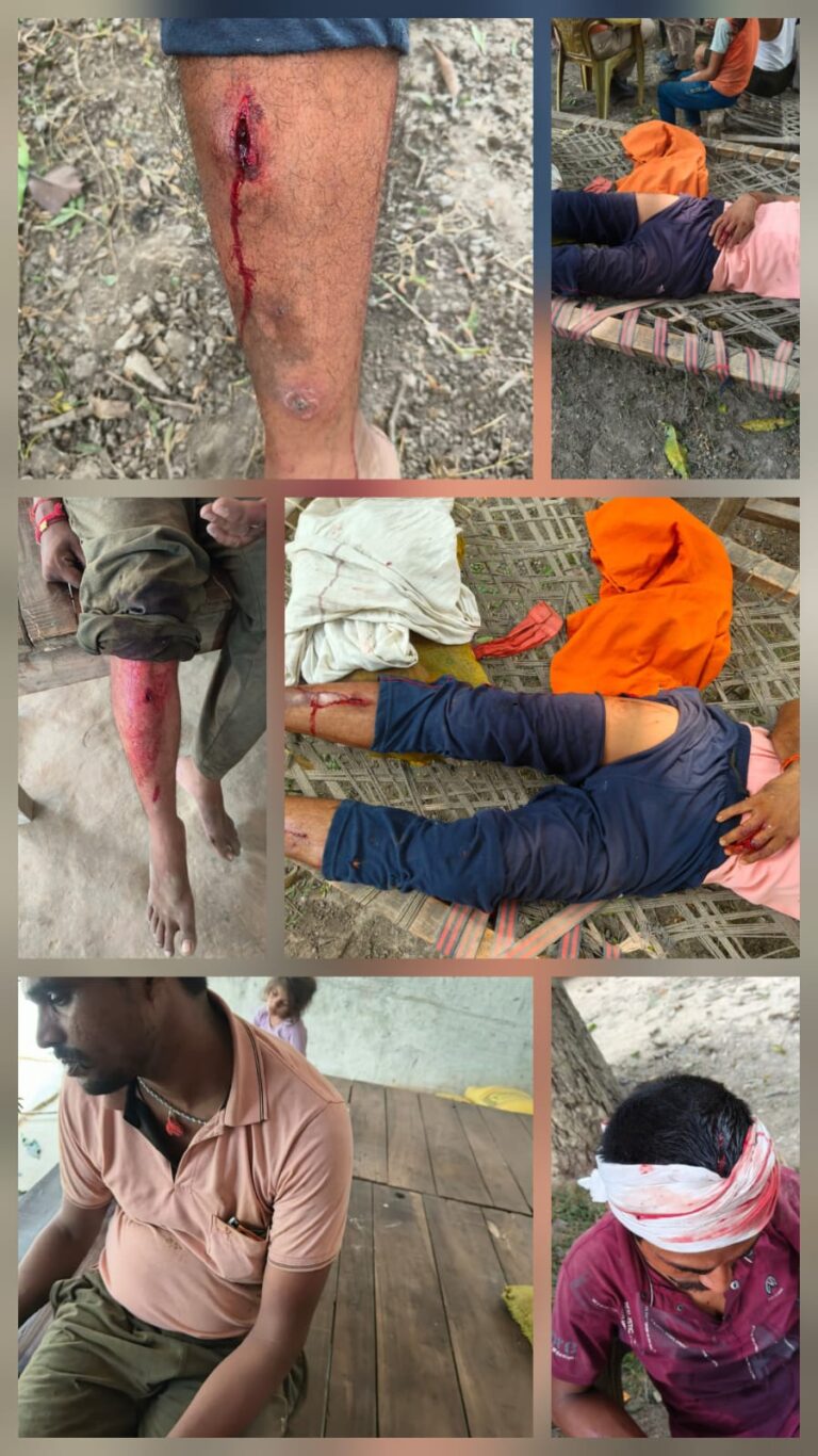 गोण्डा में जमीन विवाद बना खूनी संघर्ष, दबंगों पर पूरे परिवार को उजाड़ने की कोशिश का आरोप