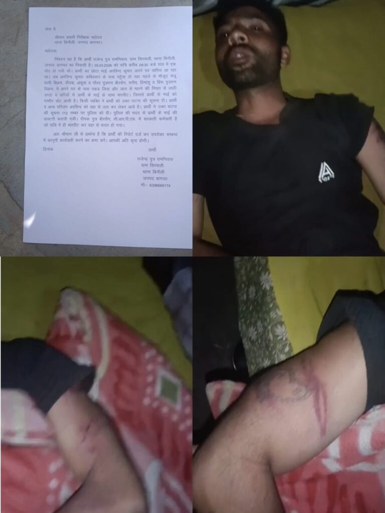 बागपत में युवक पर जानलेवा हमला, शिकायत के बाद भी कार्रवाई नहीं; आरोपियों की धमकियों से डरा सहमा पीड़ित परिवार
