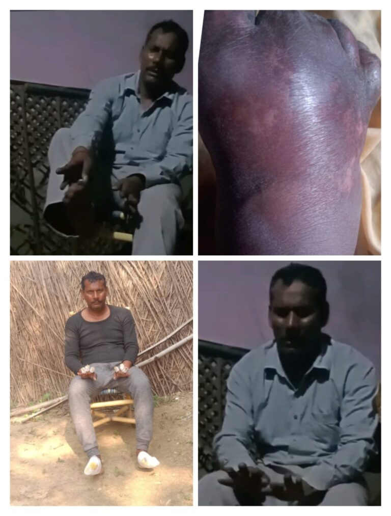 जौनपुर जिले के बदलापुर तहसील क्षेत्र से एक बेहद मार्मिक और चिंताजनक मामला सामने आया है,