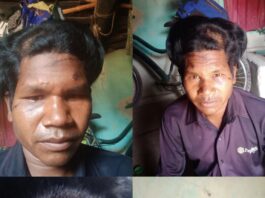 मजदूरी से लौट रहे युवक पर लाठी-डंडों से हमला, सिर फूटा; रिपोर्ट के बाद भी कार्रवाई न होने का आरोप