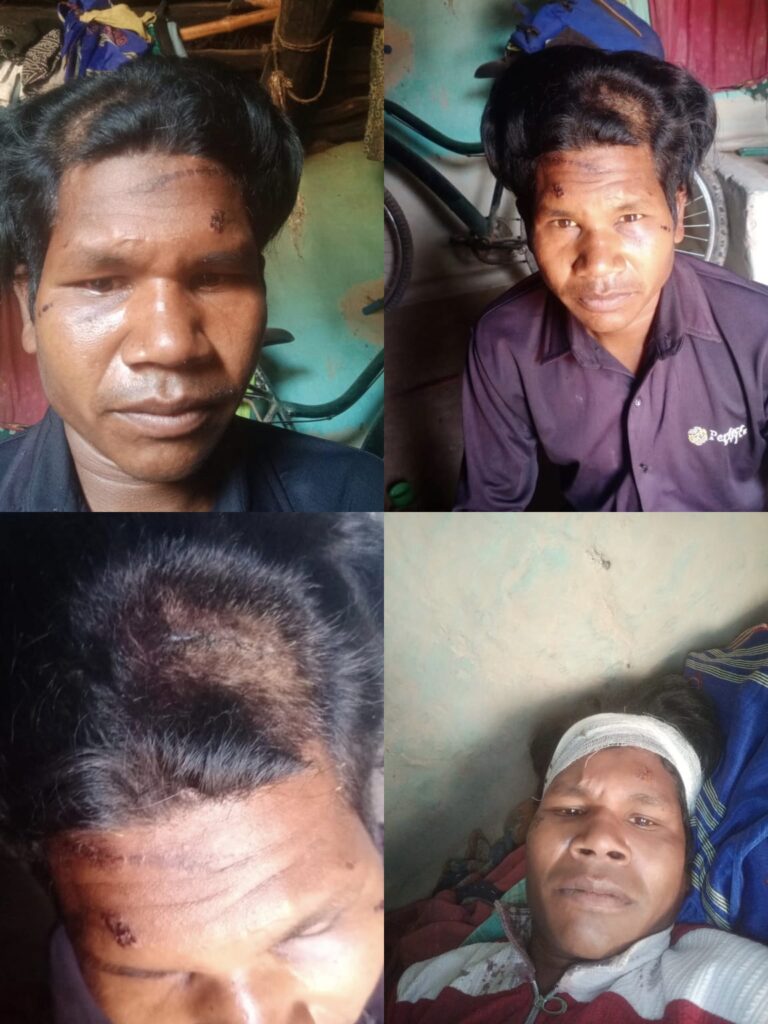 मजदूरी से लौट रहे युवक पर लाठी-डंडों से हमला, सिर फूटा; रिपोर्ट के बाद भी कार्रवाई न होने का आरोप
