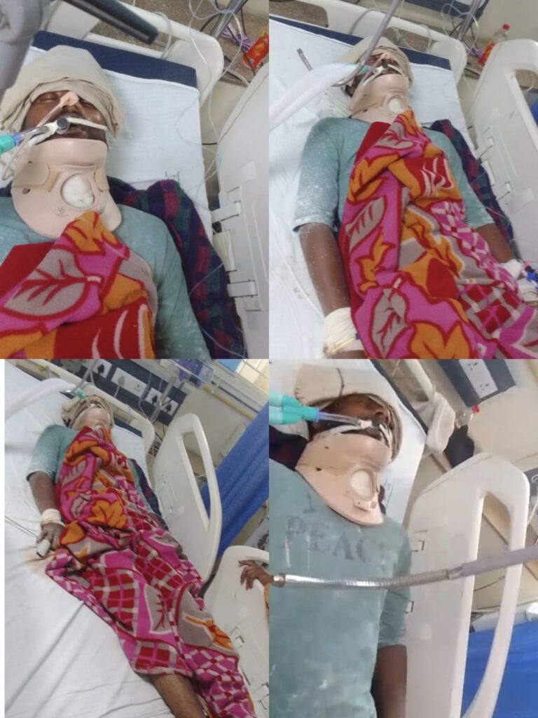 पुताई का काम करने गया युवक जिंदगी और मौत से जूझ रहा: जमींदार पर साजिश का शक, पिता बोले– धमकियां मिल रही हैं; पुलिस ने अब तक नहीं लिखी एफआईआर