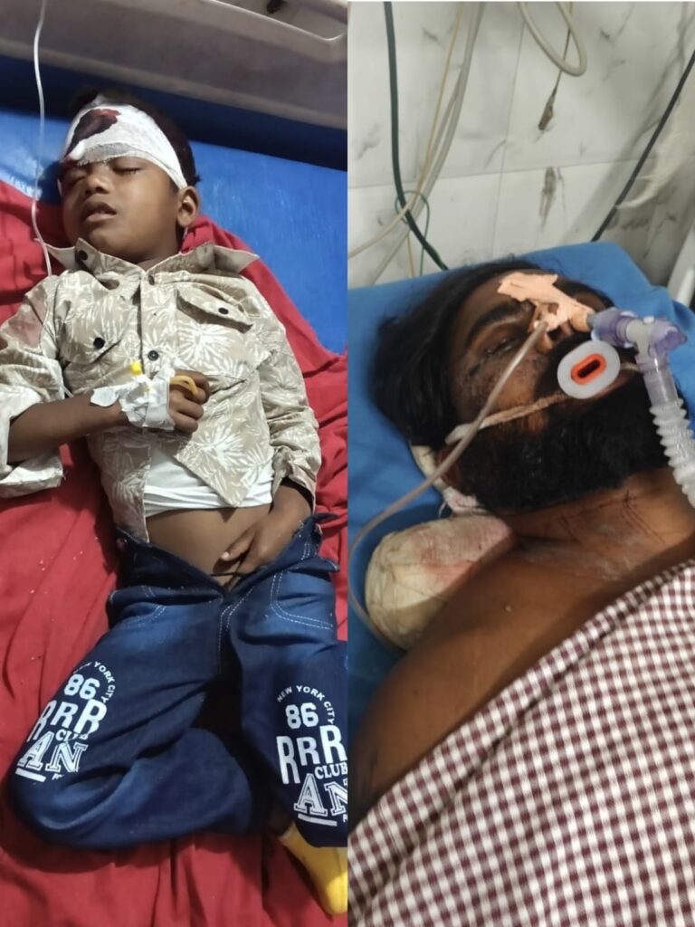 बक्सर में गरीब परिवार पर टूटा दुखों का पहाड़: पत्नी की गंभीर बीमारी, फिर पति-बेटे का सड़क हादसा; इलाज के लिए 6 लाख रुपये की मदद की अपील