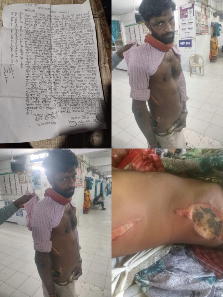 लोहे की रॉड से हमला, जिंदा जलाने की कोशिश: बेटे पर जानलेवा हमले के बाद न्याय के लिए दर-दर भटक रहा परिवार
