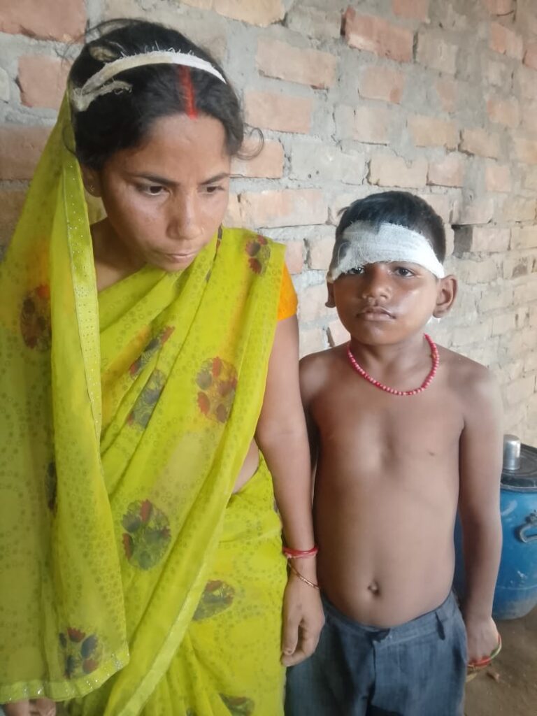 जमीन विवाद में महिला और 11 साल के बेटे पर जानलेवा हमला, गरासे और चाकू से किया हमला; आरोपियों पर केस दर्ज