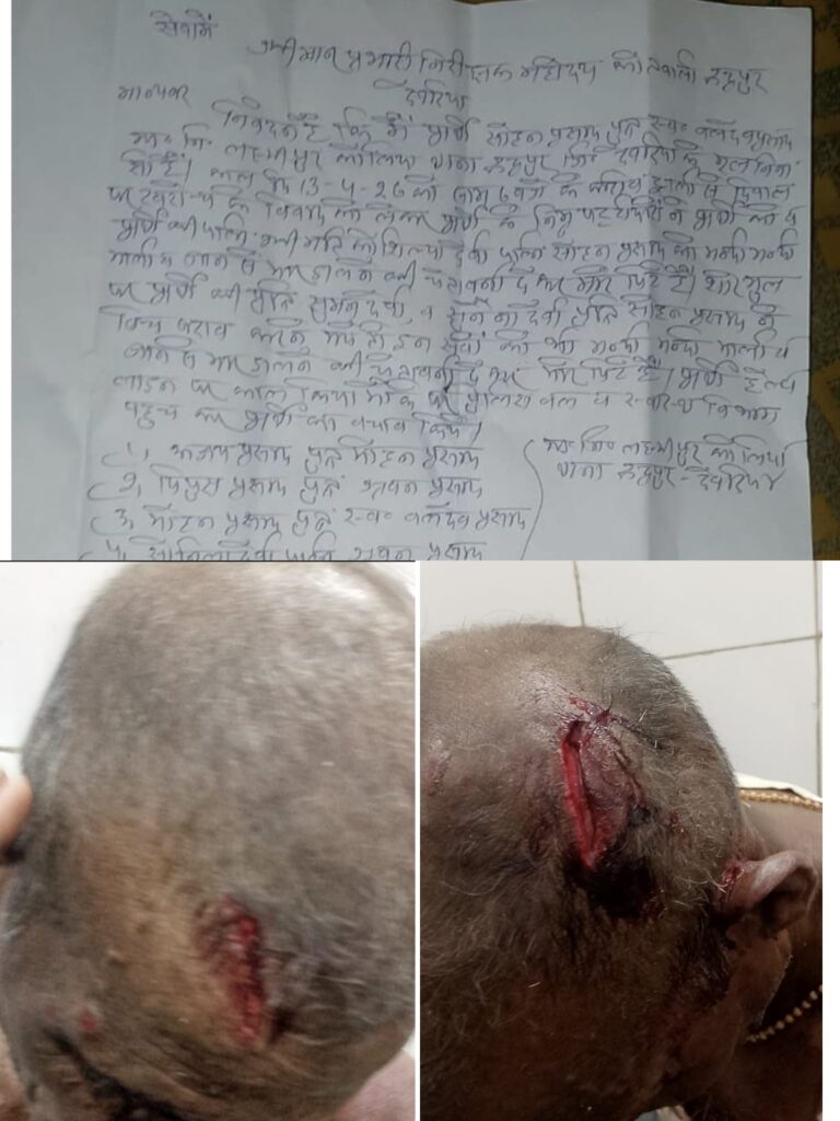 लक्ष्मीपुर कोलिया में मंदिर के पास ट्रॉली घुमाने को लेकर विवाद: परिवार पर लाठी-