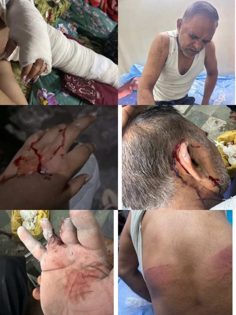 छोटी कहासुनी के बाद युवती से बर्बर मारपीट का आरोप: पिटबुल डॉग को लेकर शुरू हुआ विवाद, कपड़े खींचने की कोशिश और रेप की धमकी देने का आरोप