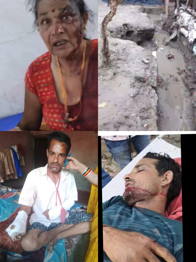 कुशीनगर में जमीन विवाद बना खूनी संघर्ष, लाठी-डंडों से हमला; मां-बेटा गंभीर घायल