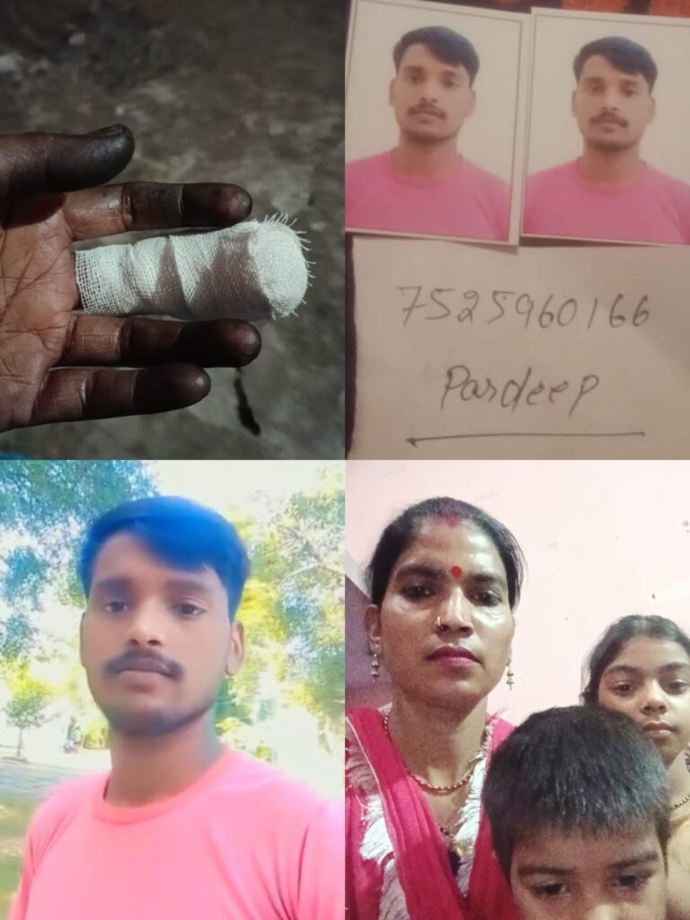 पति छोड़कर फरार, फैक्ट्री में काम करते वक्त कटी महिला की उंगली; तीन बच्चों के साथ दर-दर भटक रही पूनम ने मांगी मदद
