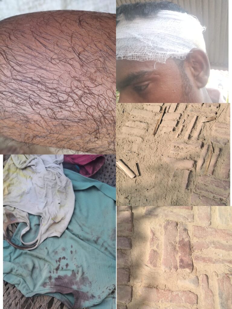 जौनपुर में गरीब मजदूर परिवार पर दबंगों का हमला! थाने पर भी नहीं हुई सुनवाई, न्याय के लिए एसपी ऑफिस तक पहुंचा पीड़ित