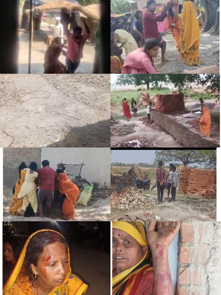 देवरिया में सरकारी जमीन पर कब्जे को लेकर खूनी संघर्ष, महिला का सिर फूटा, परिवार बोला- जमीन माफियाओं और पुलिस ने जीना हराम कर दिया
