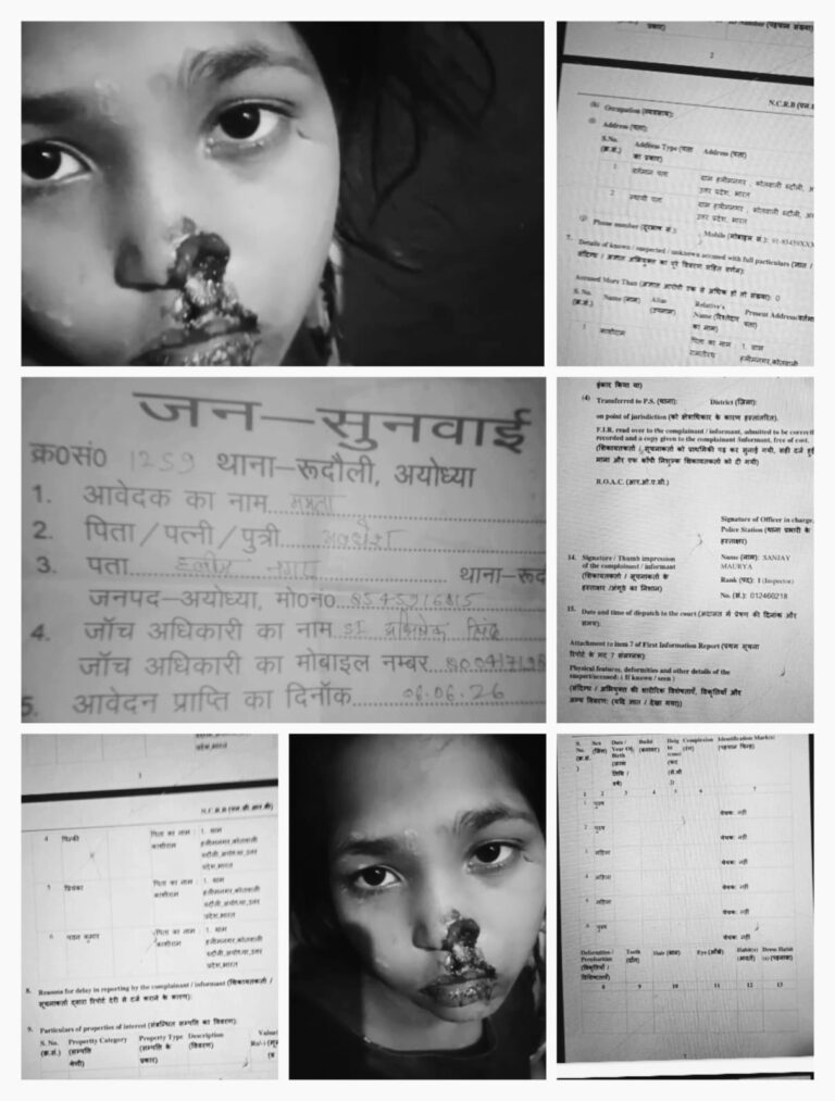 अयोध्या में 11 वर्षीय बच्ची पर हमला, नाक काटने का आरोप; कार्रवाई में देरी से पीड़ित परिवार में आक्रोश