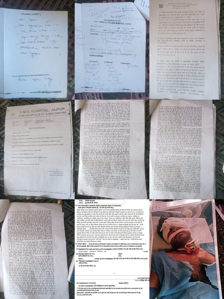 चेहरे पर 14 फ्रैक्चर, पहले हटीं गंभीर धाराएं फिर दोबारा जुड़ी धारा 308; पानी की पाइपलाइन विवाद में जांच पर उठे सवाल, पीड़ित परिवार ने लगाई न्याय की गुहार