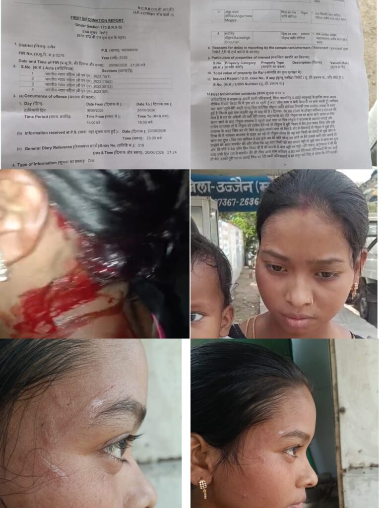 बाथरूम में छेड़छाड़ का आरोप, विरोध करने पर पति और ससुराल पक्ष ने की मारपीट; न्याय की गुहार लगा रही पीड़िता