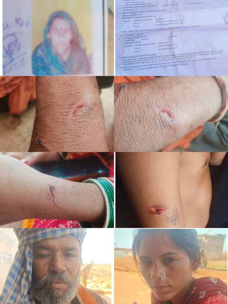 नाबालिग लड़कियों को भगाकर जबरन सगाई कराने का आरोप, विरोध करने पर परिवार पर चाकू और पत्थरों से हमला; पीड़ितों ने लगाई न्याय की गुहार