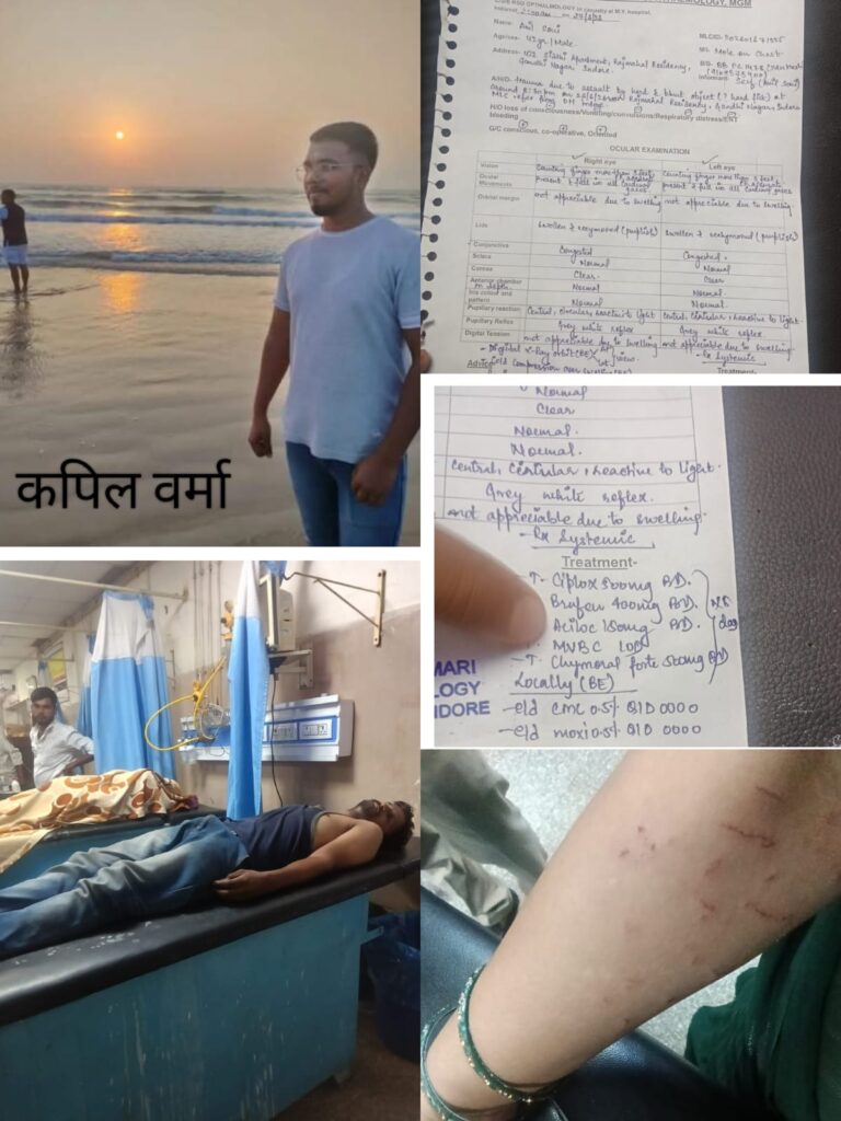 मेंटीनेंस के रुपये मांगने से शुरू हुआ विवाद बना खूनी बवाल, महिला से मारपीट का आरोप, पांच लोगों संग गुंडागर्दी और जान से मारने की धमकी से सहमा परिवार